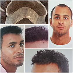 men-hair-systems2